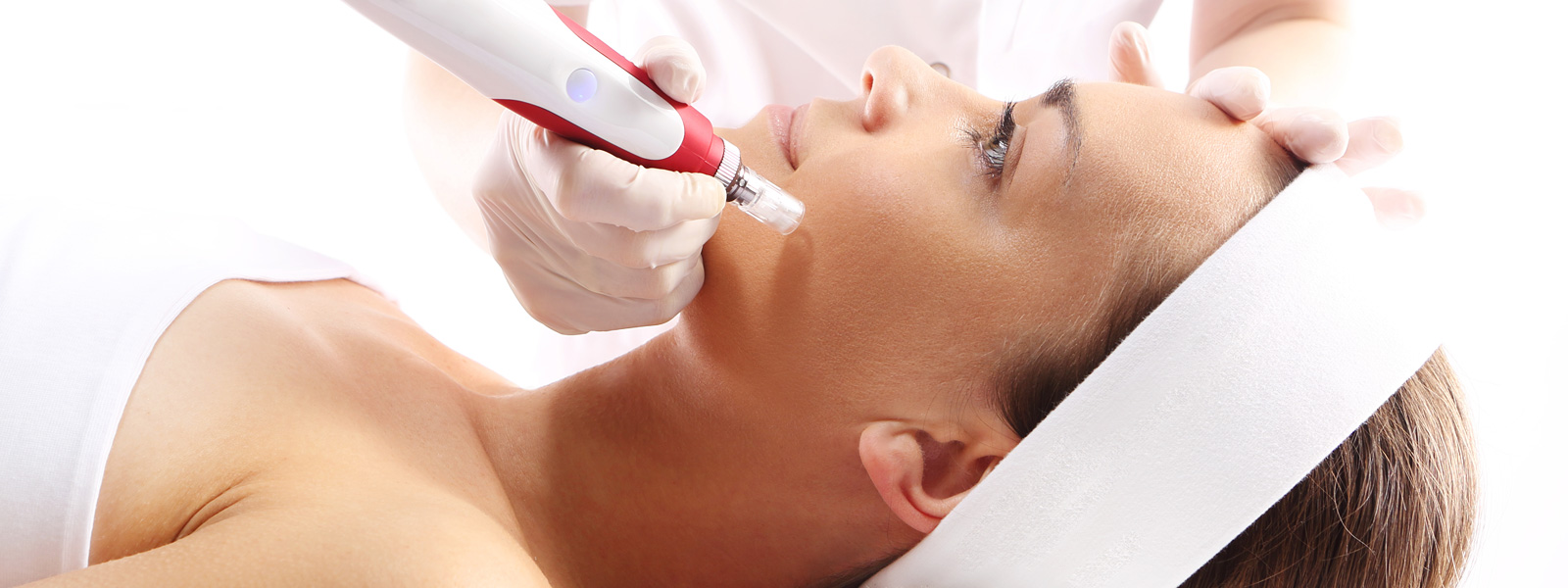Micro Needling Treatments
